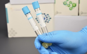 Tri-Sodium Citrate 9:1 with gel(PRP Tube)