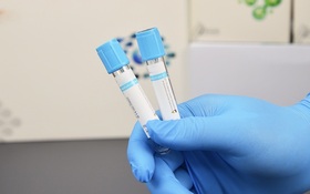 Tri-Sodium Citrate 9:1