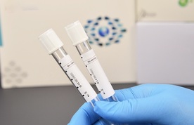 No additive tube or Plain tube