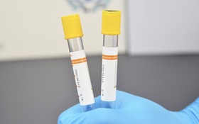 Clot activator with gel